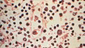 Chile báo động virus Hanta, 5 công dân Pháp xuất hiện triệu chứng sau khi đi du lịch trở về