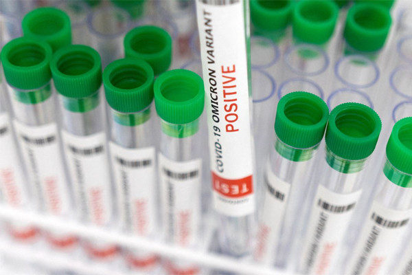 Các nhà khoa học cảnh báo về biến thể Omicron mới siêu lây nhiễm ảnh 1 Các nhà khoa học cảnh báo về biến thể Omicron mới siêu lây nhiễm ảnh 1