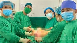 Bệnh viện Đa khoa số 3 tỉnh Lào Cai: Phẫu thuật thành công khối u buồng trứng nặng 3kg