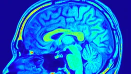 AI tạo bước đột phá quan trọng trong chẩn đoán ung thư