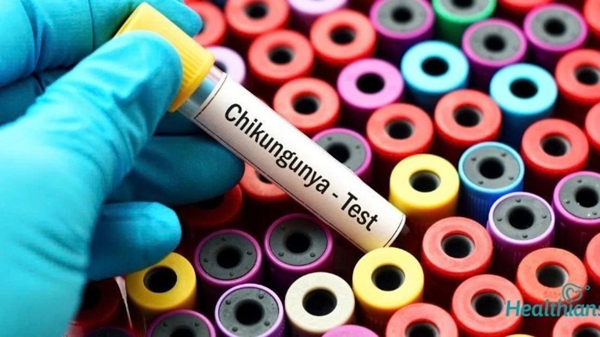 Đợt bùng phát virus Chikungunya đã bắt đầu từ đầu năm nay. 10-8-benh.jpg