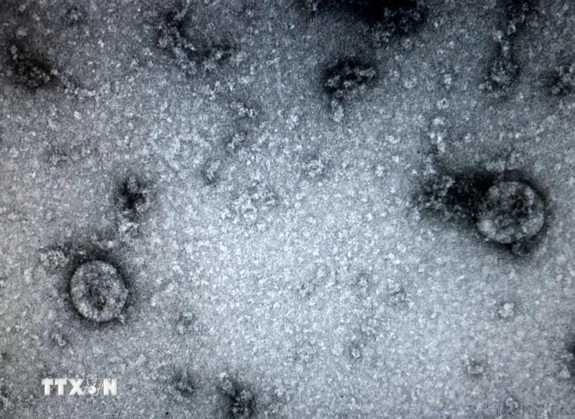 Những người từng bị nhiễm vi rút SARS-CoV-2 có thể mắc một căn bệnh nguy hiểm là hoại tử xương. (Ảnh: TTXVN phát)