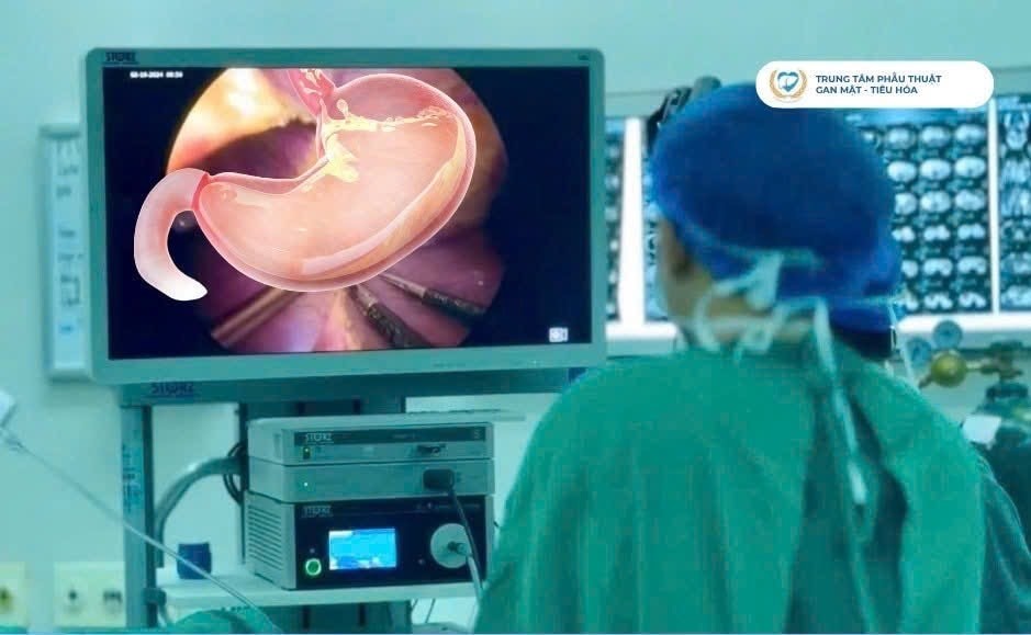 Phẫu thuật nội soi thành công ca bệnh ung thư dạ dày ở bệnh nhân có bệnh lý nền phức tạp.