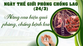 Nâng cao hiệu quả phòng, chống bệnh lao