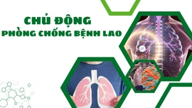 Chủ động phòng chống bệnh lao