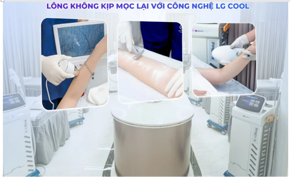 Bảng giá triệt lông vĩnh viễn mới nhất và địa chỉ triệt uy tín ảnh 2