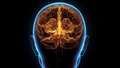 Dấu hiệu cảnh báo cơ thể đang mắc bệnh Alzheimer