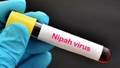 Thái Lan tăng cường kiểm soát dịch bệnh ở các sân bay trước nguy cơ virus Nipah