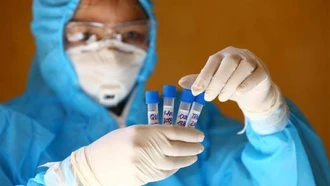 Sáng 9/8, Việt Nam có thêm 2 ca mắc mới COVID-19, trong đó 1 ca tại Hà Nội