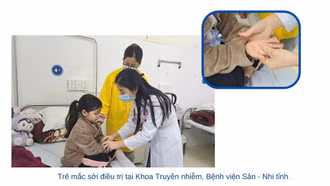 Khuyến cáo phòng bệnh sởi