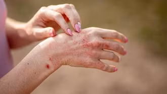 Những bệnh có thể bùng phát sau mưa lũ