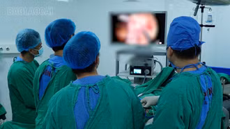 Phẫu thuật cắt đại tràng có sử dụng chất chỉ thị màu ICG