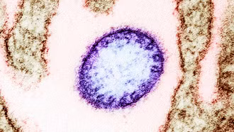 Các cơ sở y tế chủ động phòng, chống bệnh do virus Nipah