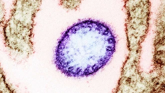 Các cơ sở y tế chủ động phòng, chống bệnh do virus Nipah