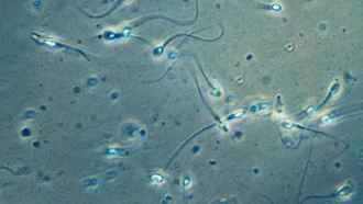 Ca mang thai đầu tiên trên thế giới nhờ phương pháp thu hồi tinh trùng do AI hỗ trợ