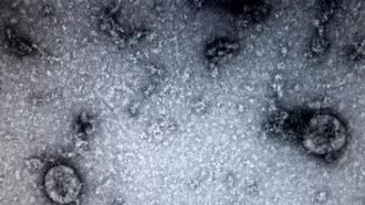 Phát hiện sự liên quan giữa Covid-19 và hoại tử xương