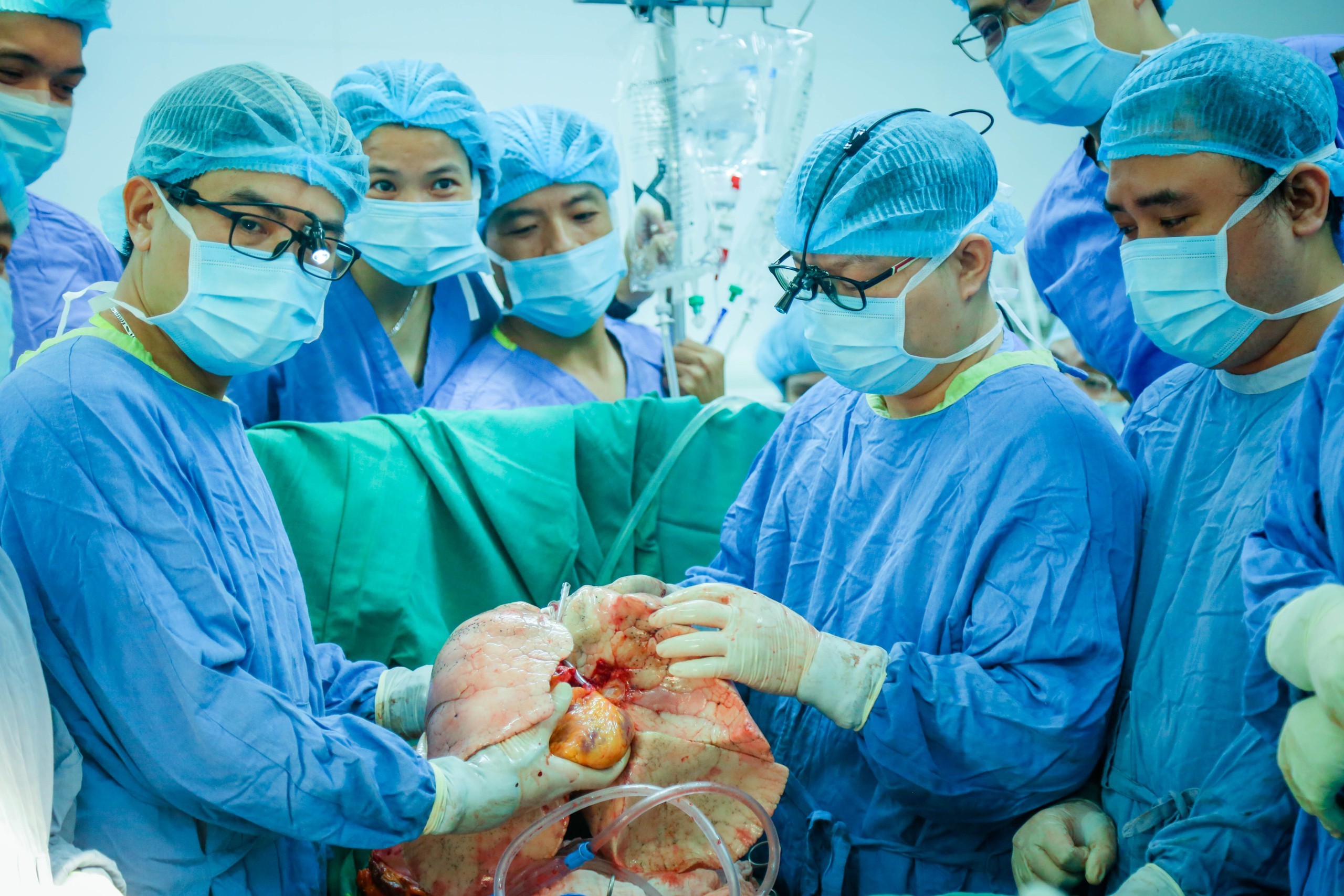 Khối tim - phổi của người hiến được chuẩn bị đưa vào ghép cho bệnh nhân. Khối tim - phổi của người hiến được chuẩn bị đưa vào ghép cho bệnh nhân.