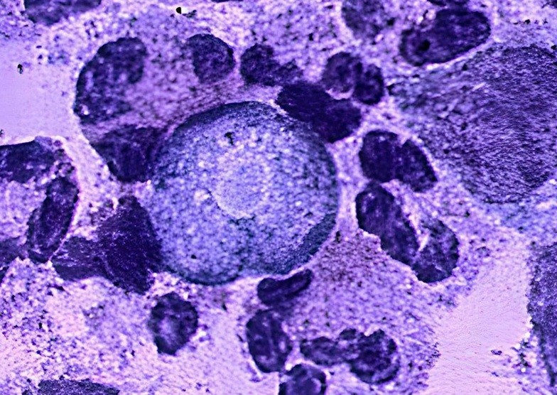 Naegleria fowleri thường sinh sống trong các ao, hồ. Naegleria fowleri thường sinh sống trong các ao, hồ.