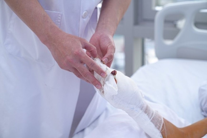 Bác sĩ chăm sóc vết thương ở tay của bệnh nhân nhi 12 tuổi ở Quảng Ninh do sử dụng pháo tự chế. Ảnh: VGP