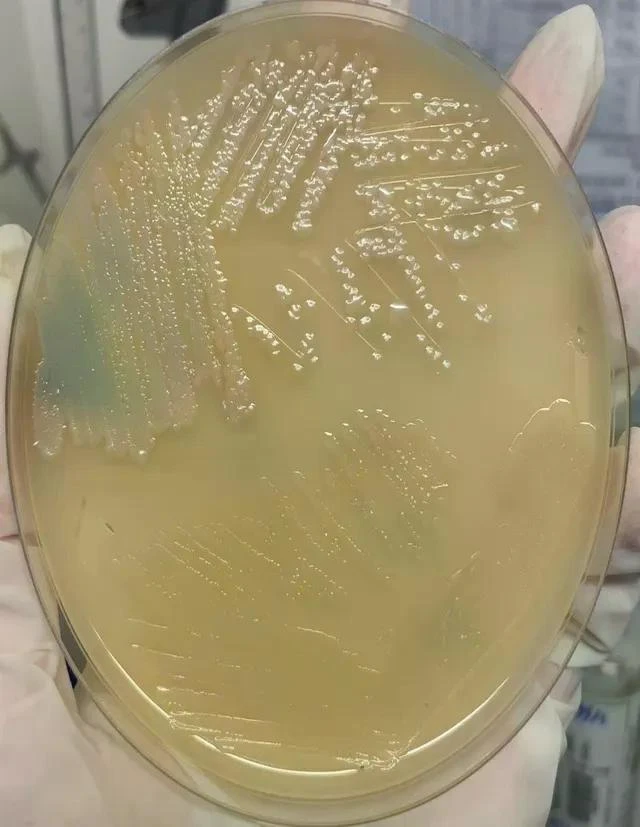 Kết quả cấy máu của bệnh nhân H.N.T.