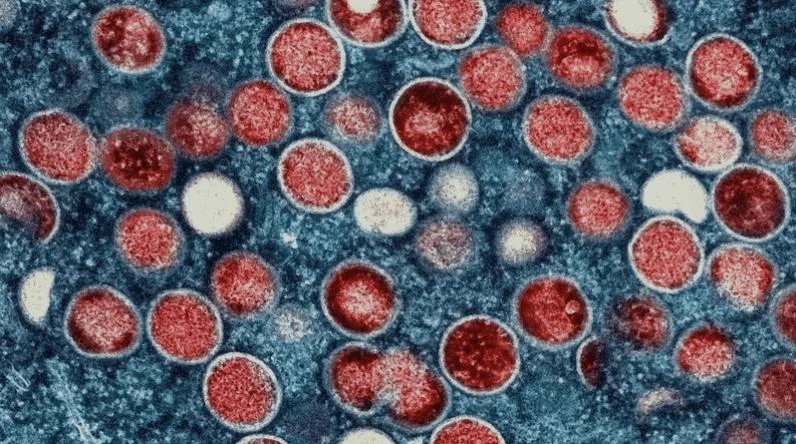 Virus đậu mùa khỉ. Ảnh: Thai PBS