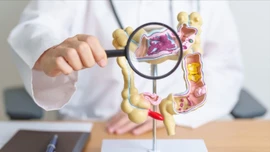 Phát triển máy in sinh học siêu nhỏ có thể chữa lành loét dạ dày