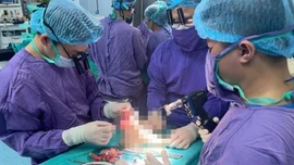 Trồng lại chi thể đứt rời cho nữ sinh 19 tuổi gặp va chạm với xe phân khối lớn