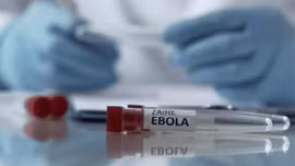 Bộ Y tế hỏa tốc yêu cầu phòng chống dịch bệnh do virus Ebola