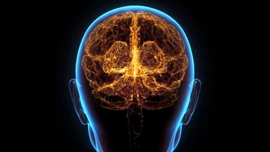 Dấu hiệu cảnh báo cơ thể đang mắc bệnh Alzheimer