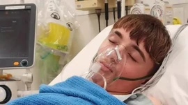 Thiếu niên phải cắt bỏ một phần phổi bị hỏng do thuốc lá điện tử