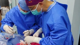 Lần đầu tiên cấy ghép thành công phổi lợn biến đổi gen vào cơ thể người