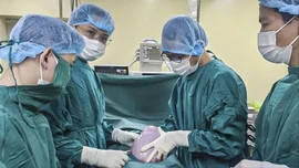 Phẫu thuật thành công, cắt khối u buồng trứng nặng 5,5 kg cho nữ bệnh nhân 19 tuổi