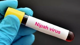 Thái Lan tăng cường kiểm soát dịch bệnh ở các sân bay trước nguy cơ virus Nipah