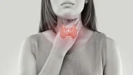 Nhân tuyến giáp: Có thực sự tan nhờ ăn uống và thảo dược?