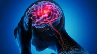 Đột quỵ ngày càng trẻ hóa
