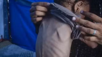 Nguy cơ nạn đói lan rộng tại hơn 15 điểm nóng toàn cầu