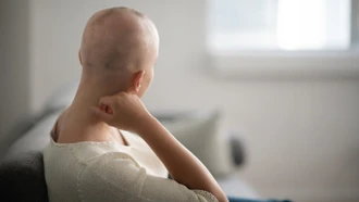 Giải pháp tiềm năng giúp bệnh nhân hóa trị hạn chế rụng tóc