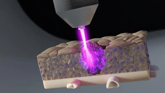 Tia plasma lạnh tiêu diệt tế bào ung thư ẩn sâu