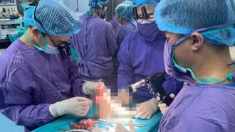 Trồng lại chi thể đứt rời cho nữ sinh 19 tuổi gặp va chạm với xe phân khối lớn