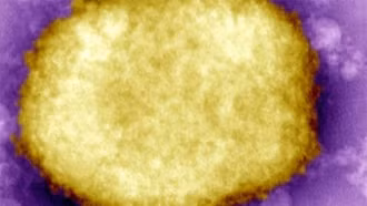 Hà Lan phát hiện trường hợp đầu tiên nhiễm biến thể đậu mùa khỉ mới