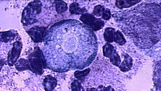 Tiểu bang Ấn Độ đối mặt với sự gia tăng số ca bệnh hiếm "amip ăn não người"