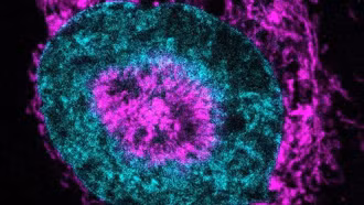 Phát hiện cơ chế "bật năng lượng" khiến tế bào ung thư có thể sống sót