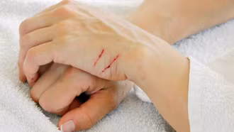 Nga chế xuất vật liệu tự chữa lành vết thương