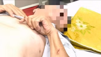 Nguy kịch vì bị chó cắn nhưng không tiêm phòng