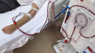 Vì sao người bị suy thận ngày càng trẻ hóa?