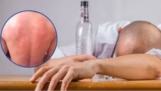 Những điều lưu ý để "giải rượu" đúng cách