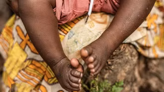 Nhật Bản xác nhận ca đầu tiên nhiễm biến thể Clade 1b của bệnh đậu mùa khỉ