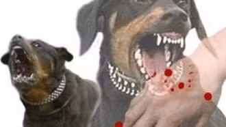 Đã có 58 ca tử vong vì bệnh dại, cần biết 6 khuyến cáo phòng chống bệnh này của Bộ Y tế