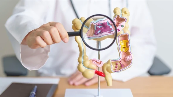 Phát triển máy in sinh học siêu nhỏ có thể chữa lành loét dạ dày