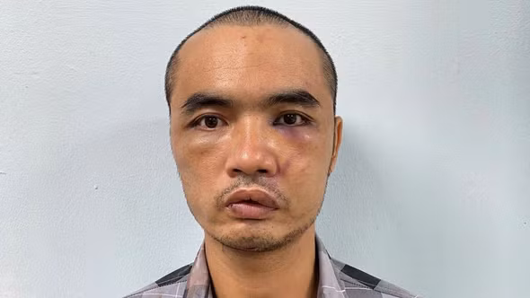 Tạm giữ khẩn cấp 01 đối tượng phá hoại nhiều ô tô